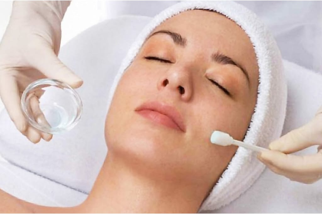 chemical peels
