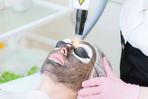 Best Hair Removal Laser In Karachi