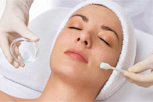 chemical peels