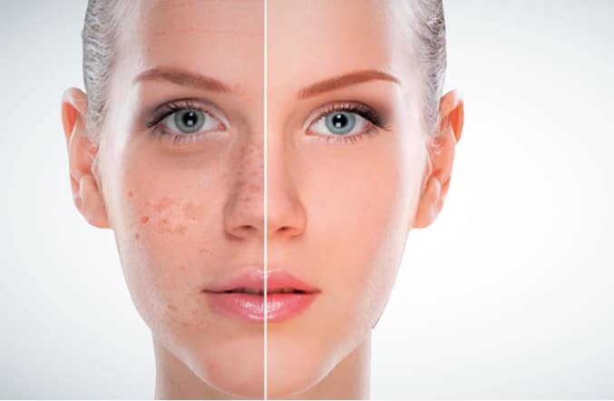 Best Skin treatment In Karachi