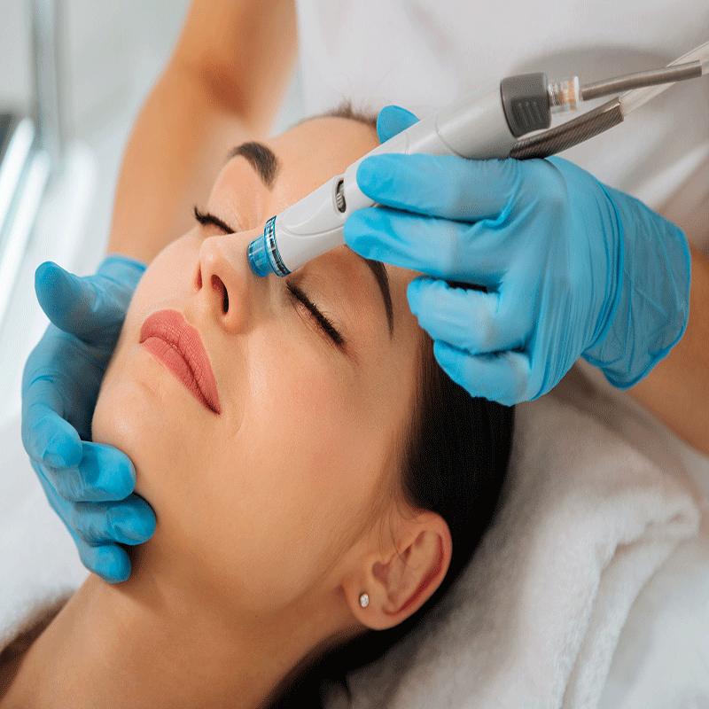 Skin Rejuvenation