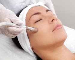 Microdermabrasion
